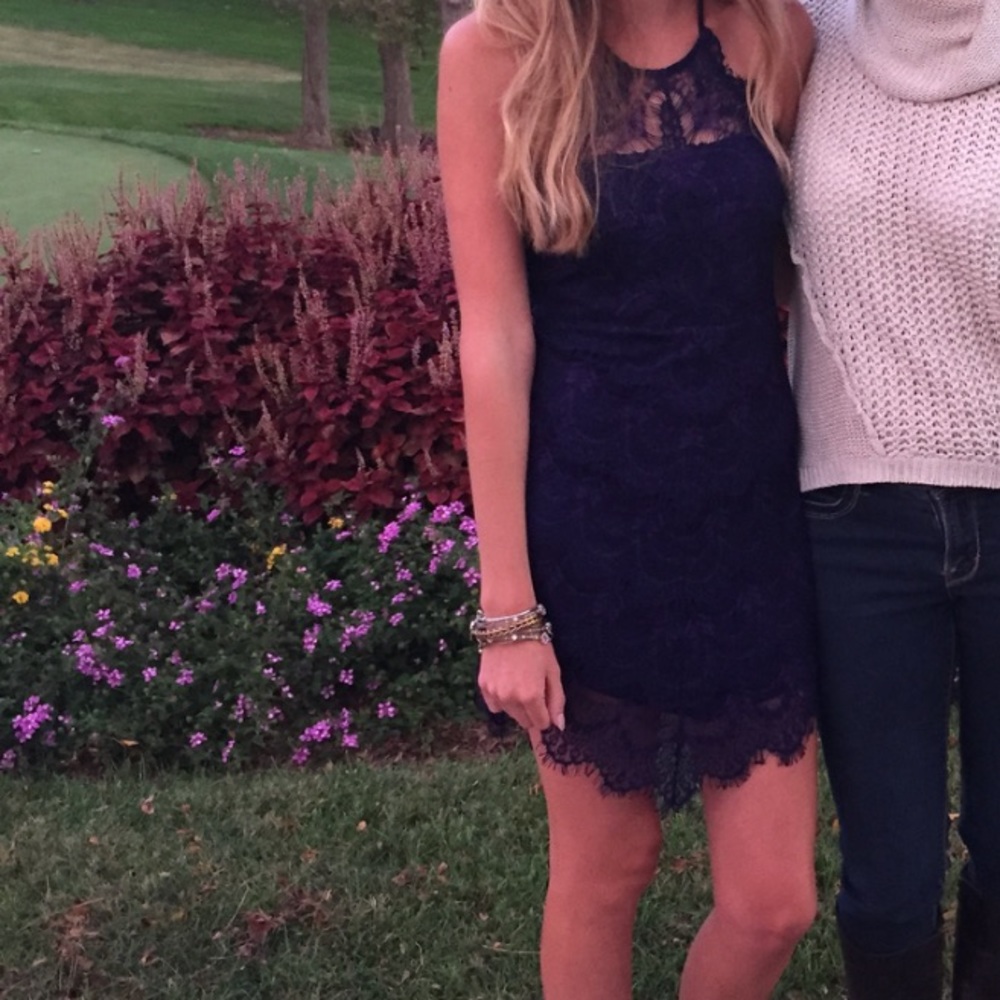 Free People blue lace dress!👗💙